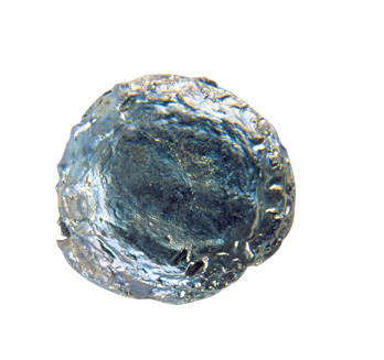 Recovered Bullet Recovered Bullet