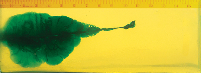 Wound Characteristics Wound Characteristics