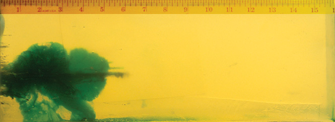 Wound Characteristics Wound Characteristics