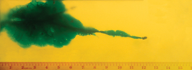 Wound Characteristics Wound Characteristics