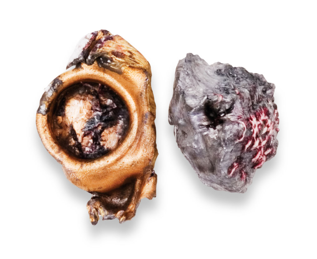 Recovered Bullet Recovered Bullet